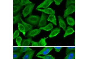 Immunofluorescence analysis of A549 cells using IFNA1 Polyclonal Antibody (IFNA1 抗体)