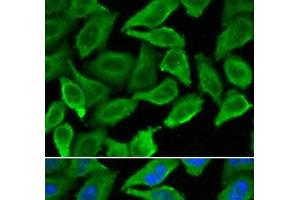 Immunofluorescence analysis of A549 cells using IFNA1 Polyclonal Antibody (IFNA1 抗体)