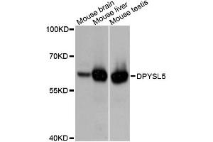 Western blot analysis of extracts of various cell lines, using DPYSL5 antibody (ABIN4903380) at 1:3000 dilution. (DPYSL5 抗体)