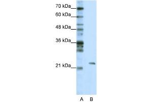 WB Suggested Anti-MRM1 Antibody Titration:  1. (MRM1 抗体  (C-Term))