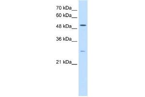 WB Suggested Anti-RRP1 Antibody Titration:  0. (RRP1 抗体  (C-Term))