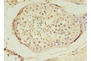 Immunohistochemistry of paraffin-embedded human testis tissue using ABIN7159638 at dilution of 1:100 (TET3 抗体  (AA 72-335))