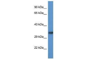 Western Blot showing ACBD6 antibody used at a concentration of 1. (ACBD6 抗体  (Middle Region))