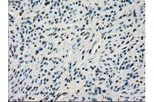 Immunohistochemical staining of paraffin-embedded colon tissue using anti-IRF3mouse monoclonal antibody. (IRF3 抗体)