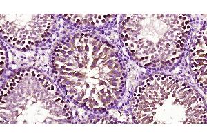 Paraformaldehyde-fixed, paraffin embedded Rat testis; Antigen retrieval by boiling in sodium citrate buffer (pH6. (FBXO15 抗体  (AA 101-200))