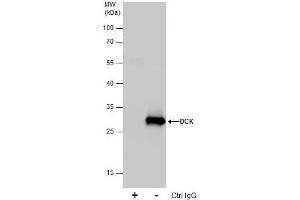 IP Image Immunoprecipitation of DCK protein from 293T whole cell extracts using 5 μg of DCK antibody, Western blot analysis was performed using DCK antibody, EasyBlot anti-Rabbit IgG  was used as a secondary reagent. (DCK 抗体  (Center))