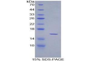SDS-PAGE analysis of Rat Osteoglycin Protein. (OGN 蛋白)