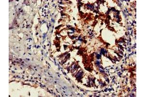 Immunohistochemistry of paraffin-embedded human lung tissue using ABIN7164202 at dilution of 1:100 (TSR2 抗体  (AA 1-191))