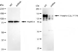 Western blotting analysis using phospho-CBL (Y774) antibody (ABIN7797878). (Recombinant CBL 抗体  (pTyr774))