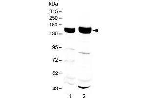 Western blot testing of 1) rat liver and 2) mouse liver with Xanthine Oxidase antibody at 0. (XDH 抗体)
