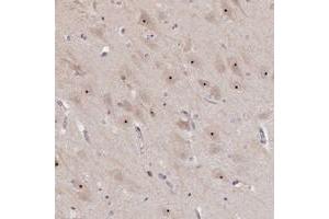 Immunohistochemical staining of human hippocampus with MGA polyclonal antibody  shows nucleolar positivity in neuronal cells at 1:500-1:1000 dilution. (MGA 抗体)