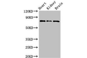 Western Blot Positive WB detected in: Mouse heart tissue, Mouse kidney tissue, Mouse brain tissue All lanes: OVGP1 antibody at 3 μg/mL Secondary Goat polyclonal to rabbit IgG at 1/50000 dilution Predicted band size: 76 kDa Observed band size: 76 kDa (OVGP1 抗体  (AA 484-678))