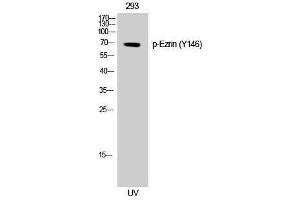 Western Blotting (WB) image for anti-Ezrin (EZR) (pTyr146) antibody (ABIN3182305) (Ezrin 抗体  (pTyr146))