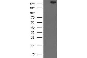 Image no. 1 for anti-SNF2 Histone Linker PHD RING Helicase, E3 Ubiquitin Protein Ligase (SHPRH) (AA 1-100), (AA 1500-1600) antibody (ABIN1490556)