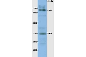 L1 human colon carcinoma lysates probed with Anti- CD138/Syndecan-1 Polyclonal Antibody, Unconjugated (ABIN674769) at 1:200 overnight at 4 °C. (Syndecan 1 抗体  (AA 201-310))