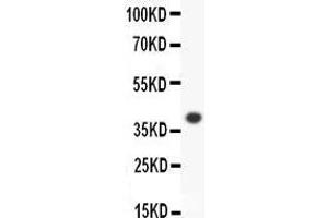 Anti-ALOX15 Picoband antibody,  All lanes: Anti-ALOX15 at 0. (ALOX15 抗体  (AA 2-337))