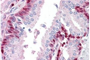 Anti-LRRFIP1 antibody IHC staining of human prostate. (LRRFIP1 抗体  (C-Term))