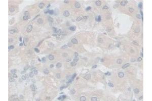 Immunohistochemistry (IHC) image for anti-Follistatin-Like 1 (FSTL1) (AA 21-308) antibody (ABIN7436609)