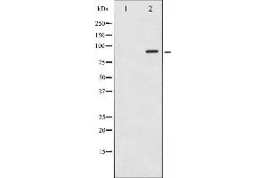 Western blot analysis of STAT6 expression in HeLa whole cell lysates,The lane on the left is treated with the antigen-specific peptide. (STAT6 抗体  (Internal Region))