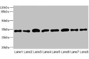 Western blot All lanes: TMBIM1 antibody at 8 μg/mL Lane 1: U251 whole cell lysate Lane 2: K562 whole cell lysate Lane 3: A549 whole cell lysate Lane 4: MCF-7 whole cell lysate Lane 5: Mouse lung tissue Lane 6: Mouse liver tissue Lane 7: Mouse kidney tissue Lane 8: Human placenta tissue Secondary Goat polyclonal to rabbit IgG at 1/10000 dilution Predicted band size: 35 kDa Observed band size: 35 kDa (TMBIM1 抗体  (AA 1-109))