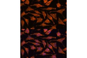 Immunofluorescence analysis of L929 cells using  antibody (ABIN7265356) at dilution of 1:100. (ABHD4 抗体  (AA 223-342))