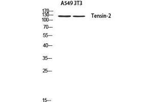 Western Blot (WB) analysis of A549 3T3 using Tensin-2 antibody. (TENC1 抗体)