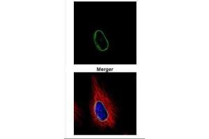 ICC/IF Image Confocal immunofluorescence analysis (Olympus FV10i) of methanol-fixed HeLa, using POM121, antibody (Green) at 1:500 dilution. (POM121 抗体  (N-Term))