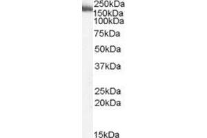 ABIN2564012 (2µg/ml) staining of Human Liver lysate (35µg protein in RIPA buffer). (MYO9B 抗体  (Internal Region))