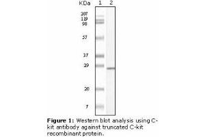 Image no. 1 for anti-Mast/stem Cell Growth Factor Receptor (KIT) antibody (ABIN232128) (KIT 抗体)