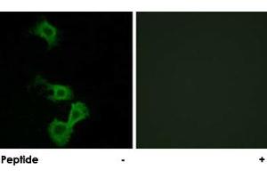 Immunofluorescence analysis of MCF-7 cells, using DAB1 polyclonal antibody .