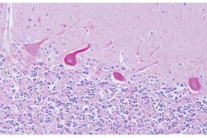 Image no. 2 for anti-GEM Interacting Protein (GMIP) (AA 804-853) antibody (ABIN6749798) (GMIP 抗体  (AA 804-853))
