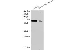 Western Blot Positive WB detected in: GPC3 antibody at 1:1000 Lane 1: Jurkat whole cell lysate Lane 2: Mouse liver tissue Secondary Goat polyclonal to Mouse IgG at 1/20000 dilution Predicted band size: 65-70KDa Observed band size: 65-70 KDa Exposure time: 5 min (Histone 3 抗体  (AA 25-559))
