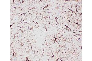 Immunohistochemistry (IHC) image for anti-Glial Fibrillary Acidic Protein (GFAP) (AA 93-432) antibody (ABIN3031046)