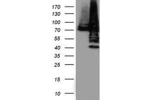 Western Blotting (WB) image for anti-Protein Disulfide Isomerase Family A, Member 4 (PDIA4) antibody (ABIN1500108) (PDIA4 抗体)