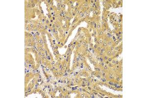 Immunohistochemistry of paraffin-embedded mouse kidney using UBE2Z antibody at dilution of 1:100 (40x lens). (UBE2Z 抗体)