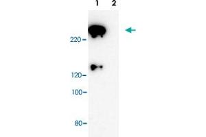 Western blot analysis of Scrib polyclonal antibody . (SCRIB 抗体)