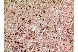 Immunohistochemistry (IHC) image for anti-Thrombopoietin (THPO) (Internal Region) antibody (ABIN6283933)