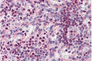 Immunohistochemistry (IHC) image for anti-Spleen Focus Forming Virus (SFFV) Proviral Integration Oncogene Spi1 (SPI1) (Internal Region) antibody (ABIN334471)