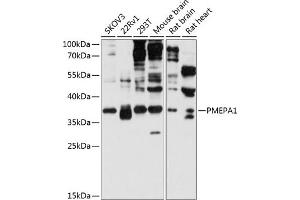 Western blot analysis of extracts of various cell lines, using PMEP antibody (2171) at 1:3000 dilution. (PMEPA1 抗体  (AA 173-252))
