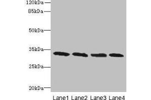 Western blot All lanes: PNP antibody at 16 μg/mL Lane 1: Jurkat whole cell lysate Lane 2: K562 whole cell lysate Lane 3: U937 whole cell lysate Lane 4: 293T whole cell lysate Secondary Goat polyclonal to rabbit IgG at 1/10000 dilution Predicted band size: 33 kDa Observed band size: 33 kDa (PNP 抗体  (AA 1-289))