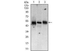 Western blot analysis using MAP2K5 mouse mAb against Jurkat (1), A431 (2), A549 (3) cell lysate.