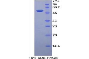 SDS-PAGE analysis of Mouse LRG1 Protein. (LRG1 蛋白)