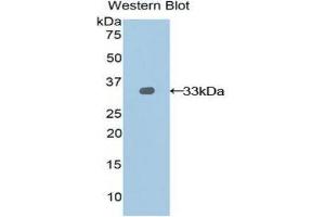 Western Blotting (WB) image for anti-Nexilin (NEXN) (AA 214-455) antibody (ABIN1859993) (NEXN 抗体  (AA 214-455))