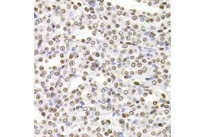 Immunohistochemistry of paraffin-embedded rat kidney using SOX5 antibody at dilution of 1:100 (x400 lens). (SOX5 抗体)