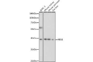 Western blot analysis of extracts of various cell lines, using NEU1 antibody (ABIN6129462, ABIN6144538, ABIN6144539 and ABIN6221903) at 1:1000 dilution. (NEU1 抗体  (AA 156-415))