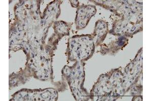 Image no. 2 for anti-5'-Nucleotidase, Cytosolic II (NT5C2) (AA 1-562) antibody (ABIN599188) (NT5C2 抗体  (AA 1-562))