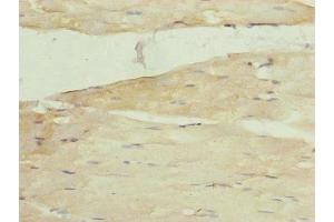 Immunohistochemistry of paraffin-embedded human skeletal muscle tissue using ABIN7142260 at dilution of 1:100 (MRPS22 抗体  (AA 1-360))
