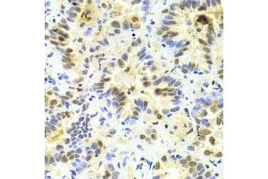 Immunohistochemistry (Paraffin-embedded Sections) (IHC (p)) image for anti-serine/arginine-Rich Splicing Factor 1 (SRSF1) (pSer1) antibody (ABIN3022320)
