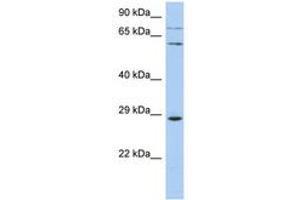 Image no. 1 for anti-Zinc Finger Protein 490 (ZNF490) (AA 107-156) antibody (ABIN6742632) (ZNF490 抗体  (AA 107-156))