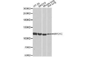 Western blot analysis of extracts of various cell lines, using MYO1C antibody (ABIN2564004) at 1:1000 dilution. (Myosin IC 抗体)